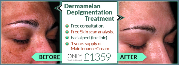 Dermamelan Depigmentation Treatment