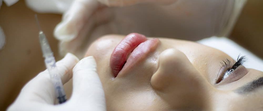 What to Do After Lip Fillers: 16 Aftercare Tips - Wimpole Aesthetics